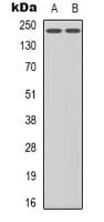 Polyclonal Rabbit anti-Human KDR / VEGFR2 / FLK1 Antibody (C-Terminus, IHC, IF, WB)