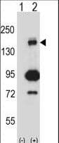 MAP3K5 / ASK1 Antibody (aa1175-1203)
