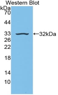 NRG1 / Heregulin / Neuregulin Antibody (aa20-242, clone C3)