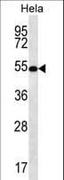 SCHIP1 Antibody (aa90-118)