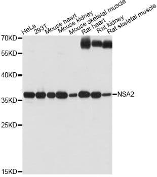 Hypothetical Protein / TINP1 Antibody