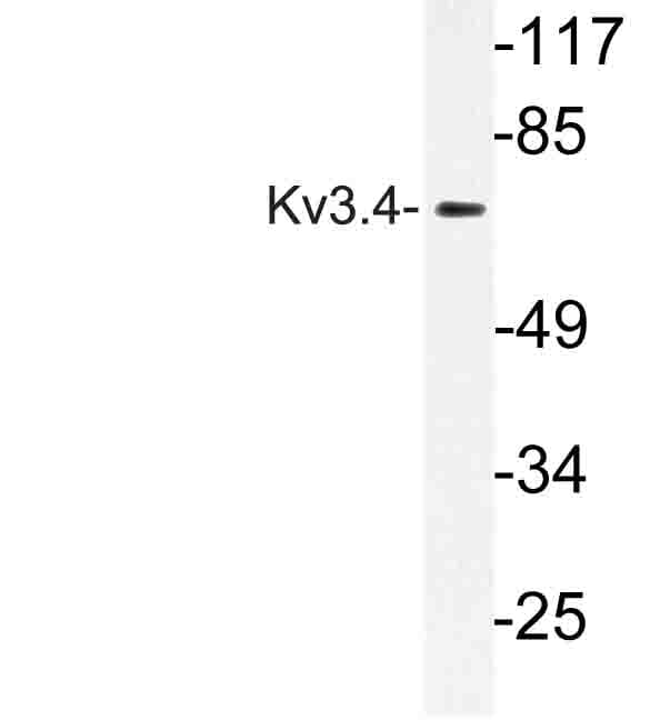 KCNC4 / Kv3.4 Antibody (Arg11)
