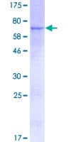 Human ZNF620 Protein (Recombinant GST)