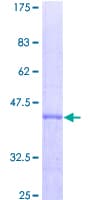 Human ACAT1 Protein (Recombinant GST)