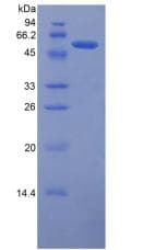 Human SLC40A1 / Ferroportin-1 Protein (Recombinant His-GST)