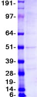 Human CD52 Protein (Recombinant Myc-DDK (Flag))
