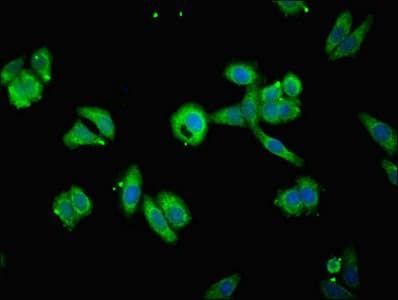 TIMM10B / FXC1 Antibody