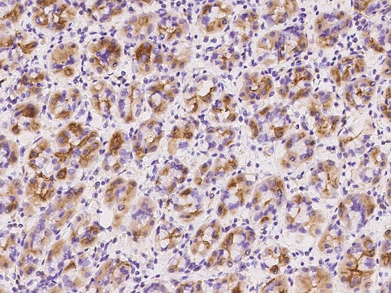 CLECSF6 / DCIR Antibody