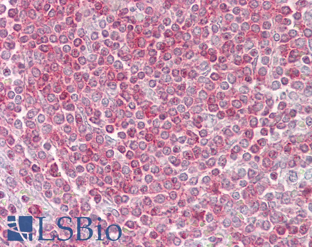 RIPK3 / RIP3 Antibody (aa251-300)