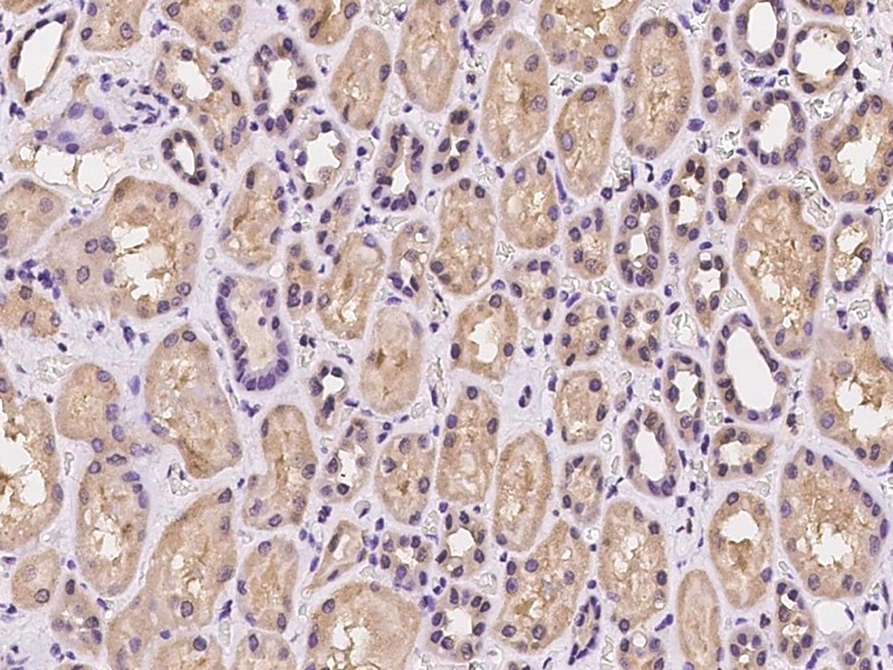 DCTN6 / Dynactin 6 Antibody