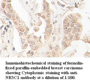 Polyclonal Rabbit anti-Human NR3C1/Glucocorticoid Receptor Antibody (IHC)
