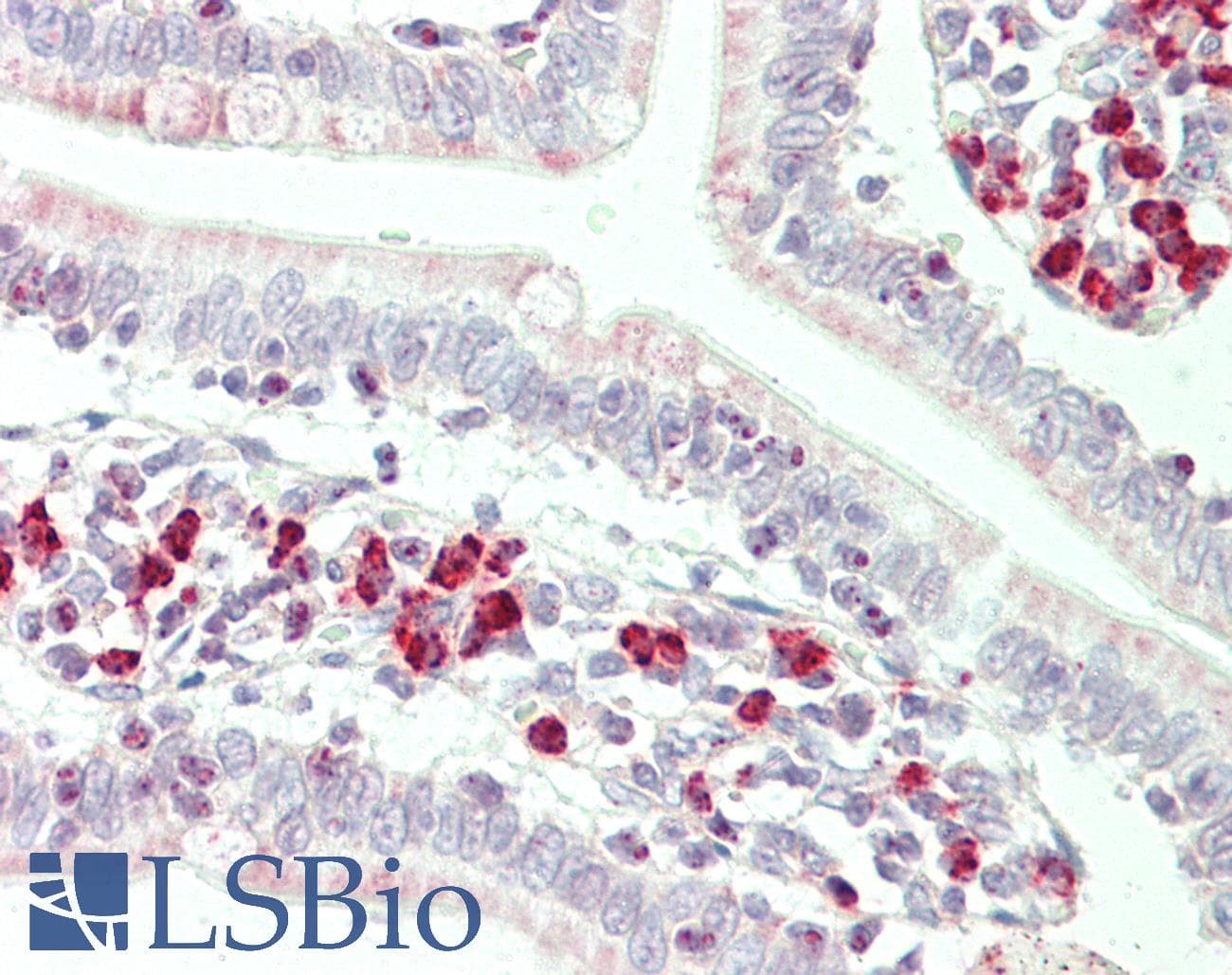IHC-plus™ RNF125 / TRAC-1 Antibody (aa131-180)