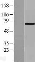 LIMK1 / LIMK Protein (Over-Expression Lysate Myc-DDK (Flag))