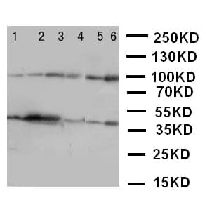 NFKB1 / NF-Kappa-B Antibody (aa778-797)