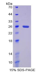 Rat IL4R / CD124 Protein (Recombinant His)