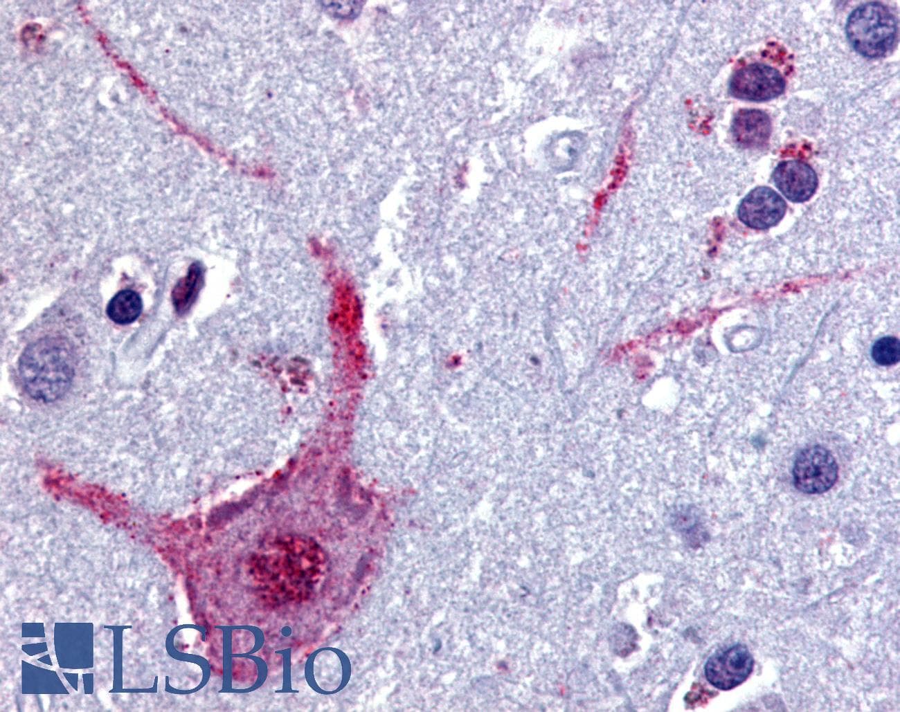 IHC-plus™ Polyclonal Rabbit anti-Human CHRM3 / M3 Antibody (Cytoplasmic Domain, IHC)