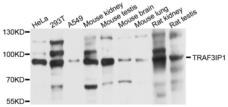 Polyclonal Rabbit anti-Human TRAF3IP1 Antibody (WB)