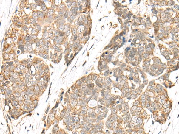 COA7 / SELRC1 Antibody