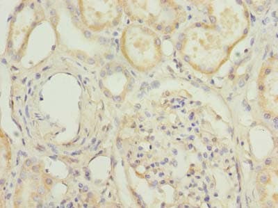 HPCAL1 / Hippocalcin-Like 1 Antibody