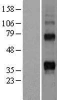 Human TNFSF11 / RANKL / TRANCE Protein (Over-Expression Lysate Myc-DDK (Flag))