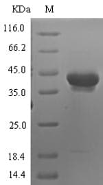 Human Neurotrypsin Protein (Recombinant 6His-SUMO, N-terminus)