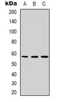 Polyclonal Rabbit anti-Human DKC1 / Dyskerin Antibody (Internal, IHC, IF, WB)