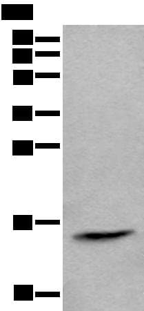 Polyclonal Rabbit anti-Human CCL21 / SLC Antibody (WB)