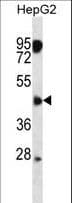 Polyclonal Rabbit anti-Human CLMP / ACAM Antibody (aa81-110, IHC, WB)