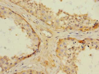 Polyclonal Rabbit anti-Human NRBP1 / NRBP Antibody (IHC)