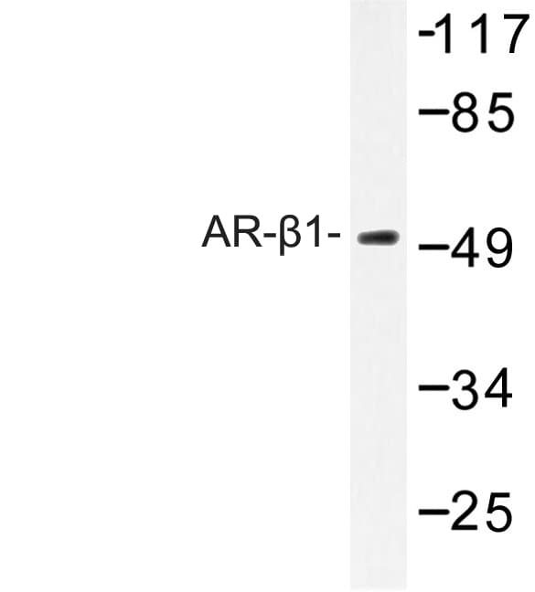 ADRB1 Antibody