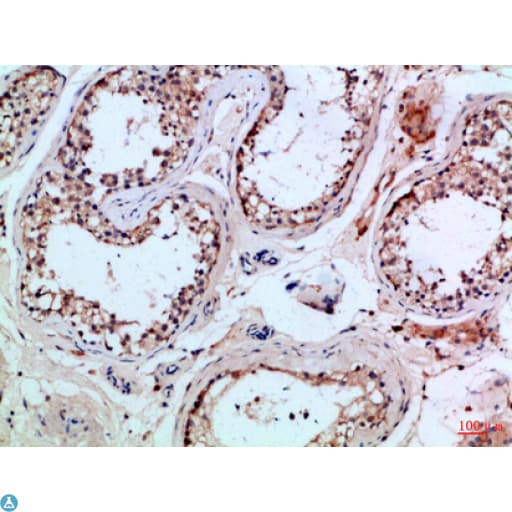 PIK3R2 / p85 Beta Antibody