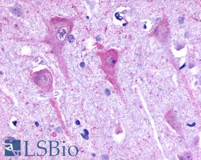 PathPlus™ P2RY8 / P2Y8 Antibody (C-Terminus)
