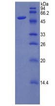 Human APP / Beta Amyloid Precursor Protein (Recombinant His-MBP)