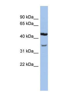 KCNK4 / TRAAK Antibody (N-Terminus)