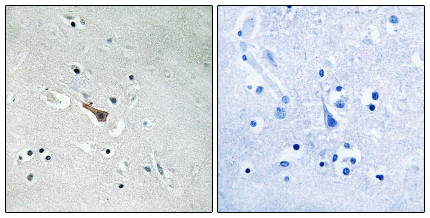 Polyclonal Rabbit anti-Human APLP2 Antibody (phospho-Tyr755, IHC)