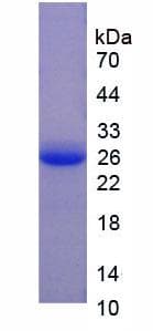 Pig F5 / Factor Va Protein (Recombinant His-S)