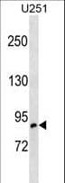 OSBPL10 Antibody (aa669-695)