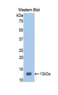 HPSE / Heparanase Antibody (aa34-115)