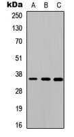 CTSO Antibody (Internal)