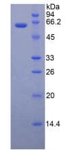 Mouse TERT / Telomerase Protein (Recombinant His-GST, N-terminus)