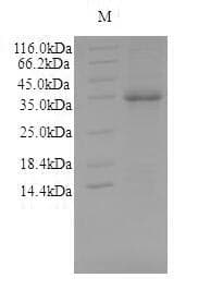 Mouse ASAH1 / Acid Ceramidase Protein (Recombinant 10His-SUMO, N-terminus + Myc, C-terminus)