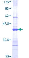 Human VNN1 Protein (Recombinant GST, N-terminus)