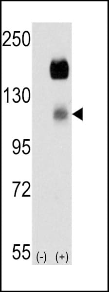 Polyclonal Rabbit anti-Human CCK4 / PTK7 Antibody (aa21-52, IHC, WB)