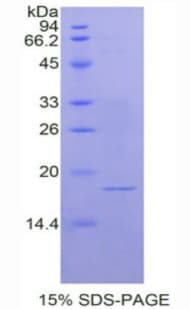 Rat ANXA2 / Annexin A2 Protein (Recombinant His, N-Terminal)