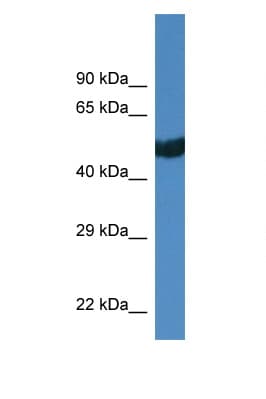 THRA / THR Alpha Antibody (aa325-374)