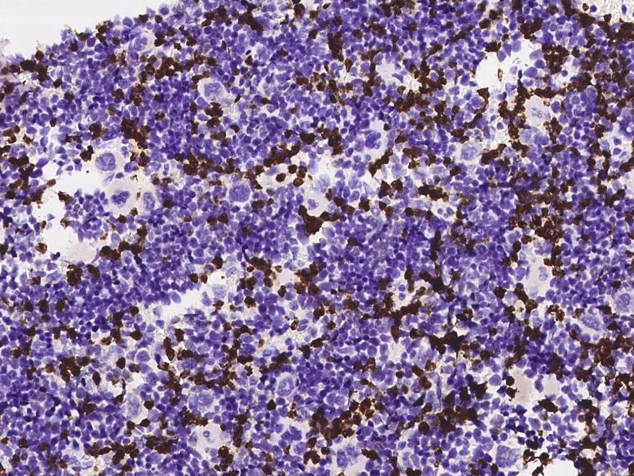 MMP8 Antibody