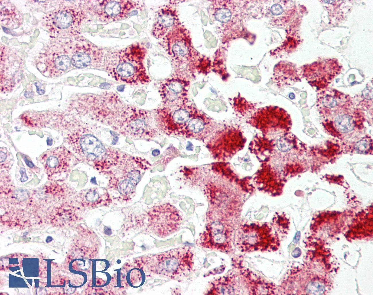 IHC-plus™ SCP2 / SCPX Antibody (aa163-175)