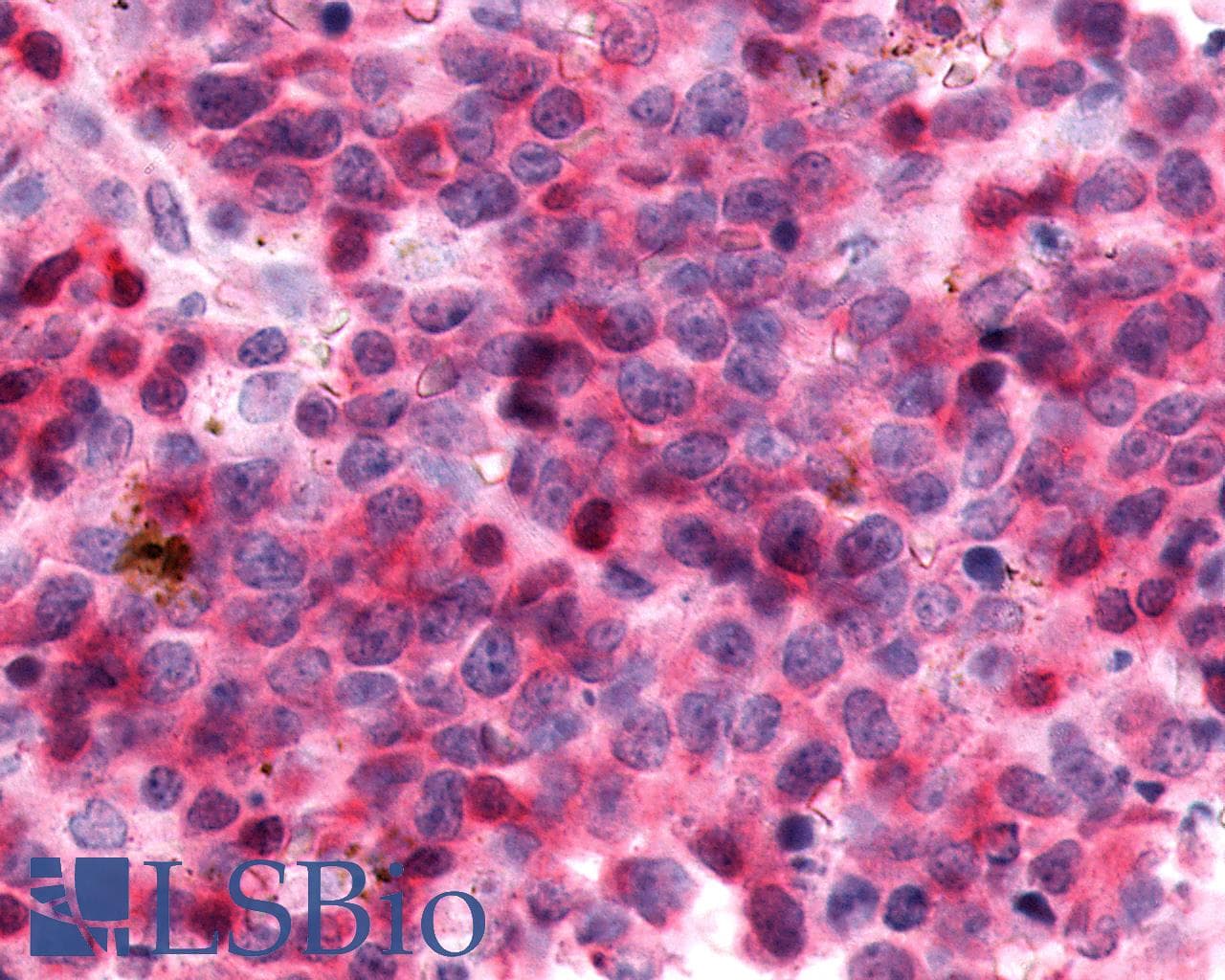 PathPlus™ SSTR3 Antibody (C-Terminus)
