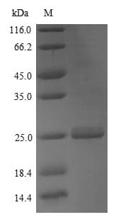 Mouse APOM / Apolipoprotein M (Recombinant 6His, N-terminus)