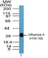 Influenza A Virus H1 Antibody (aa205-220)